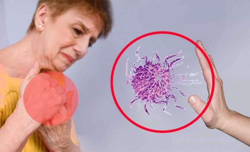 Artritis Reumatoide: Qué es, Síntomas, Causas, Tratamiento Natural