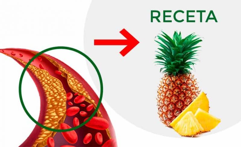 ¿Cómo usar la piña para bajar el colesterol? Receta correcta y remedio