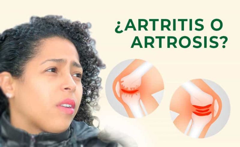 Diferencias entre Artritis y Artrosis: Causas, síntomas, diagnóstico, tratamiento