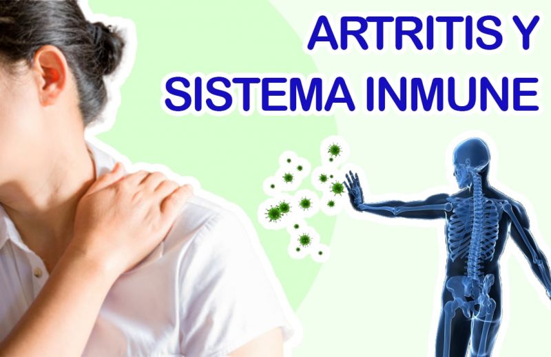 Artritis, una enfermedad del Sistema Inmune