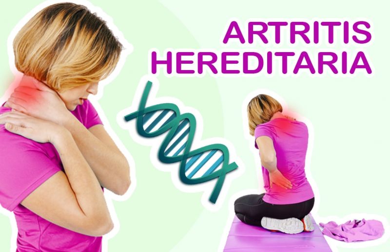 ¿La Artritis es Hereditaria?