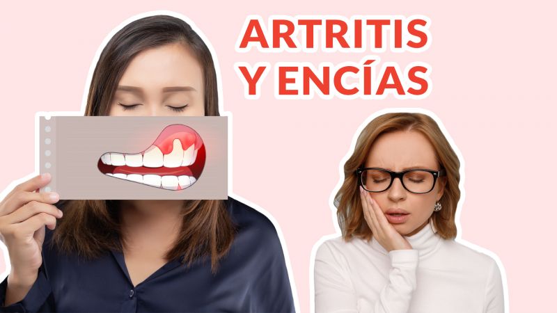 Artritis y Encías: ¿Sabías que el tratamiento de tus dientes puede aliviar el dolor de articulaciones?