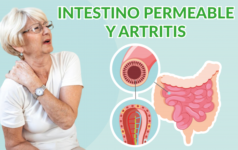 Intestino permeable y Artritis