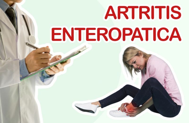 Artritis Enteropática