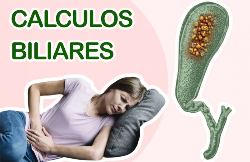 Cálculos Biliares