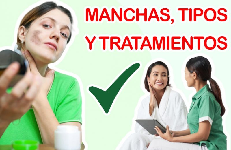 Manchas en la piel: ¿Qué tipos hay y cuáles son sus tratamientos?