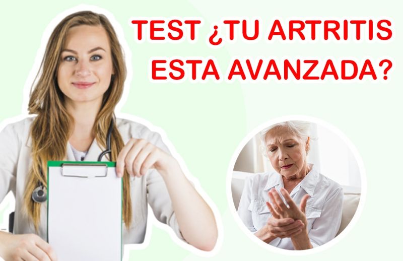Test para Saber SÍ Tu Artritis está Avanzando