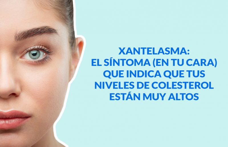 Xantelasma: El síntoma (en tu cara) que indica que tus niveles de Colesterol están muy Altos