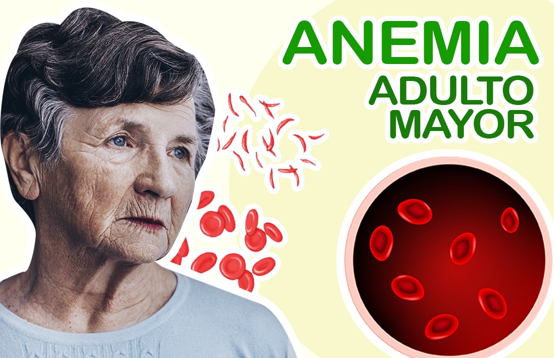 Anemia en adultos mayores