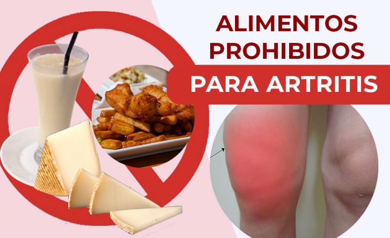 3 Alimentos Prohibidos para la ARTRITIS que Aumentan el dolor en las Articulaciones