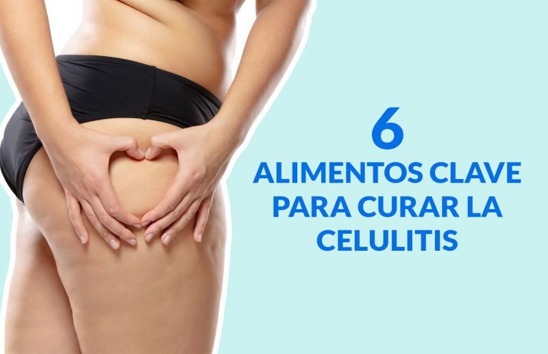 Celulitis: 6 alimentos clave para curar esta afección…
