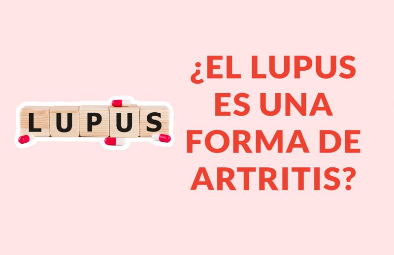 ¿El lupus es una forma de artritis?