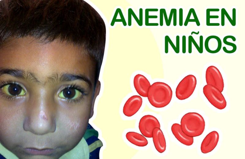 Anemia en Niños