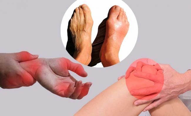 Artritis Reumatoide: 10 síntomas iniciales | Nuevas Evas