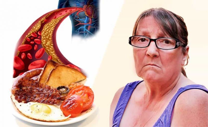 Colesterol Alto: Qué es, Síntomas, Causas, Tratamiento Natural