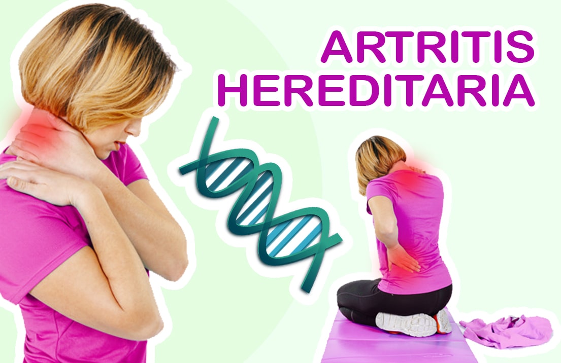 ¿La Artritis es Hereditaria? — Nuevas Evas
