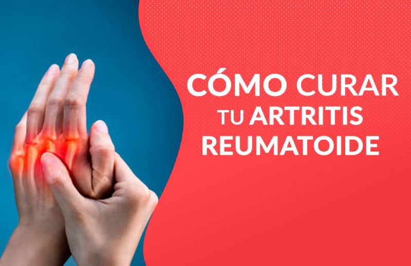 ¿Cómo curar tu Artritis Reumatoide?